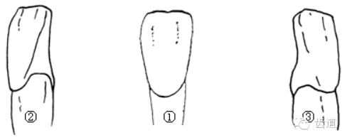 近远中径 唇舌径. 8.切缘大致在唇舌向的中央. 9.弯曲征基本上没有.