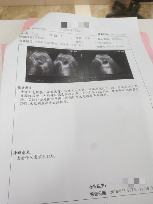 体检查出来左侧附件囊实性包块 麻烦大家帮看