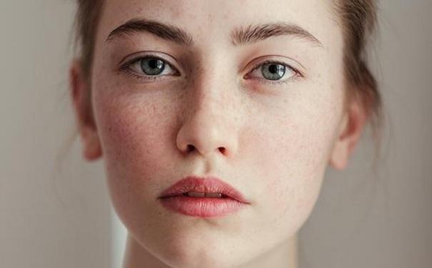 脸上长斑的原因!