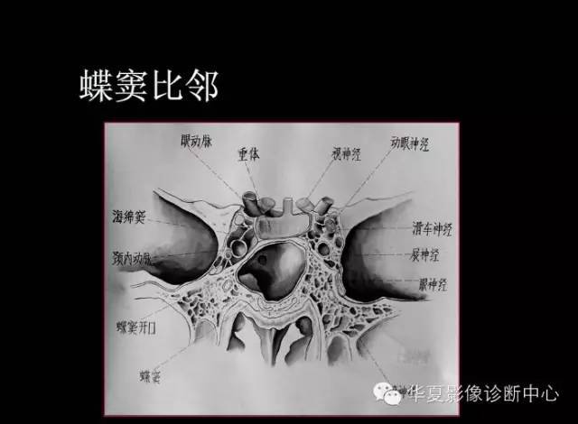 标本 影像,深度剖析 — 鼻骨,鼻副窦解剖