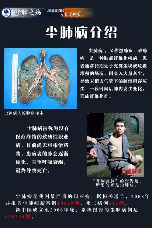 尘肺之殇:建筑业农民工生存图片展