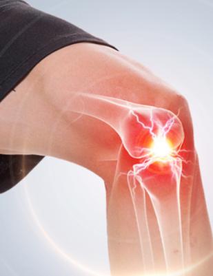 注意了,以下几类人群最容易出现膝盖损伤继而导致的关节炎