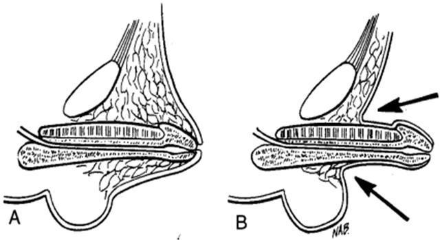 睾丸|生理性|腹壁_鸵鬃订阅