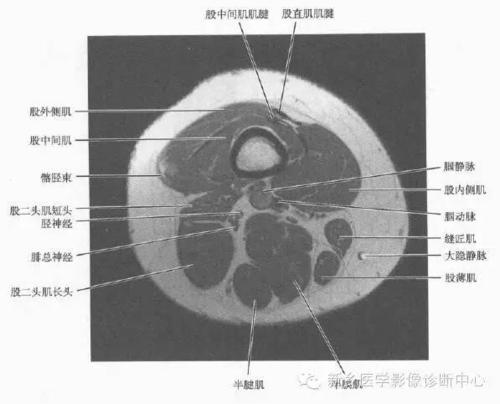 大腿解剖 详细标注