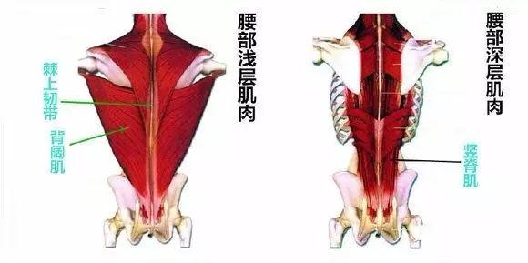 怎样来区分腰肌劳损和腰间盘突出呢?