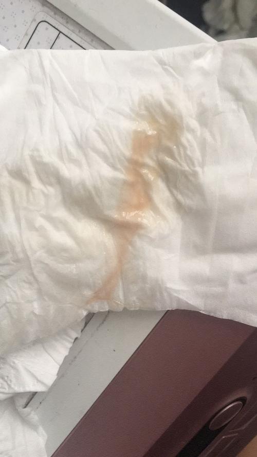 38周2天早上起来发现有血性分泌物,不是很多,这是快要生了么?