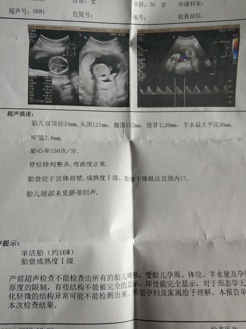 热心网友帮我看下三个月半月了,看下b超是女孩还是男孩,懂的会看的看