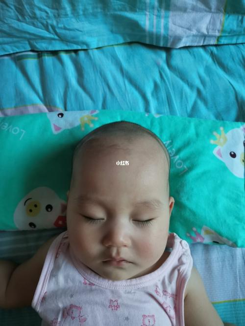 这是方颅吗?_伊可新怎么样_太阳穴凹陷_母婴_育儿