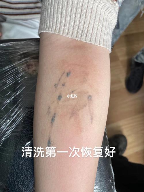 清洗纹身第一次恢复后效果返图及二次清洗_纹身_掉色