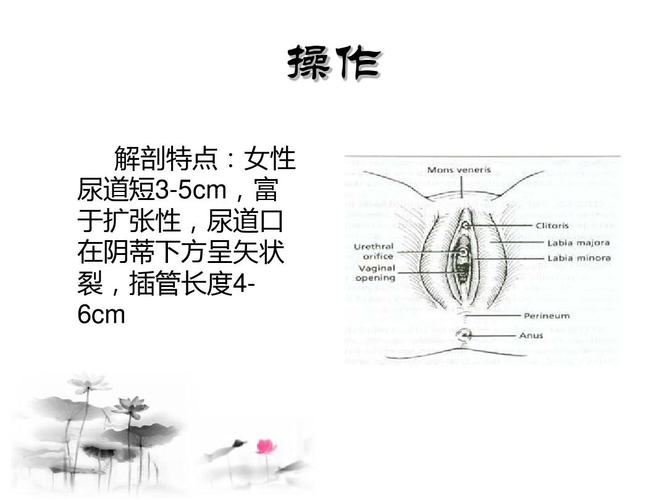 操作 解剖特点:女性 尿道短3-5cm,富 于扩张性,尿道口 在阴蒂下方呈矢
