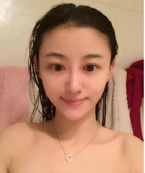 最美演员徐婷:沦为家庭"赚钱工具", 年少患癌全身溃烂