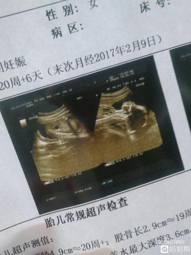 有没有宝宝四肢短小的,求正能量