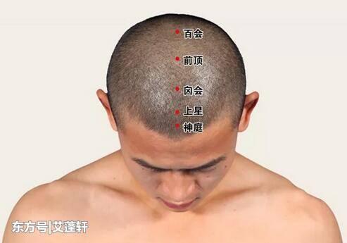 百会,人中,风池,迎香……这些穴位的名称到底因何而来?
