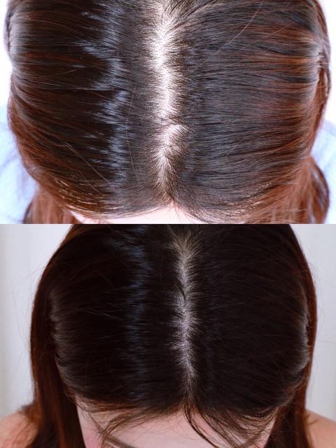 【抵挡脱发!让发际线逆龄的有效生发分享!】 随着