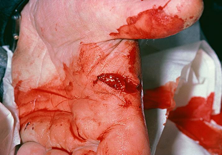 撕破,不寻常,风景,手掌,大拇指,食指