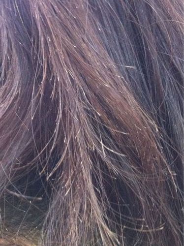 岳灵生发看 头发干枯