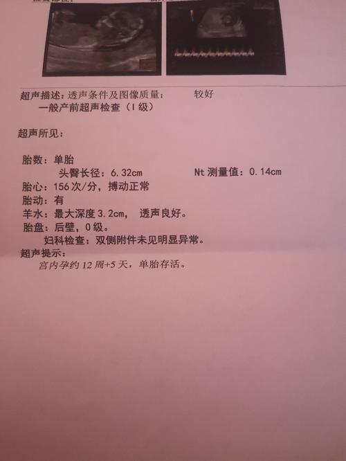 nt看男女 nub图片非常清晰的情况下准确率还是挺高的