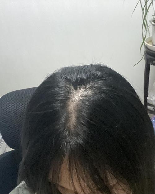 请姐妹们看看这样算秃头吗?