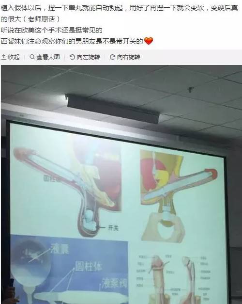 假体隆丁丁,想硬就硬,这样的雄风你要吗?