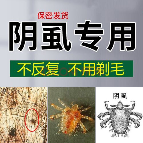 阴虱男女士私处阴虱林ld旦成人佳用去虱子膏硫磺软膏阴虱硫磺喷剂百部