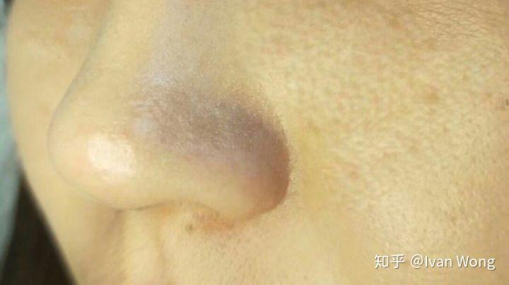 上妆都要厚厚的一层,还是疙疙瘩瘩的