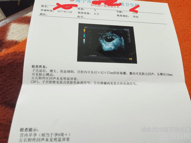 我这是怀孕9周多了吗怎么b超看起来都那