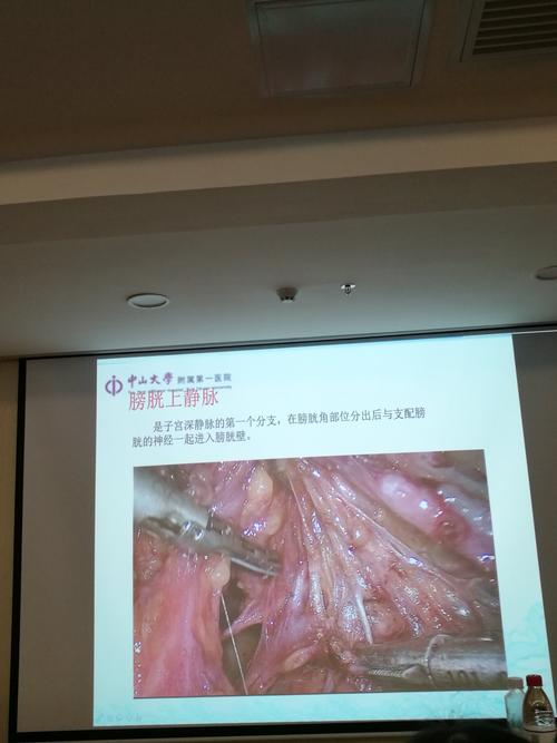 孑宫颈周围解剖一姚书忠