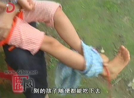 三班镇桥内村:6岁女孩患孤独症不断自虐