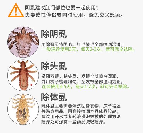热卖去儿童头虱虱立净除阴虱灭虱精百部酊去虱卵虱子药成人一扫光喷雾