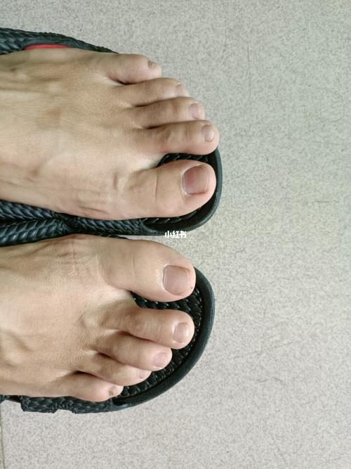 我的脚指甲_医疗健康_医疗健康其他