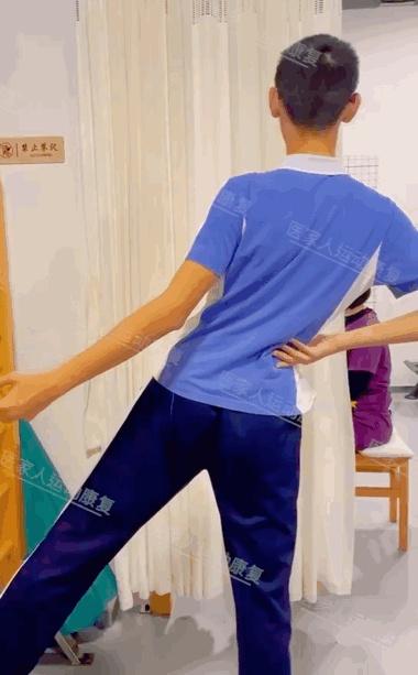 脊柱侧弯康复13岁男孩康复治疗后脊柱回直身体回归中线摆脱脊柱侧弯