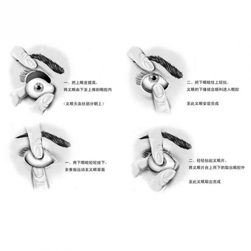佩戴范围:   1,眼球摘除,义眼座植入者;   2,眼球萎缩,先天性小
