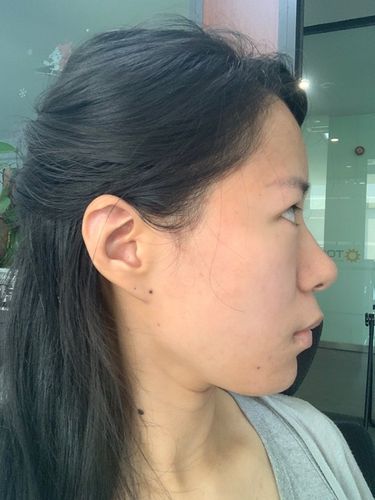 左图舌头没用力,右图舌头用力顶上颚了,下巴就不会那