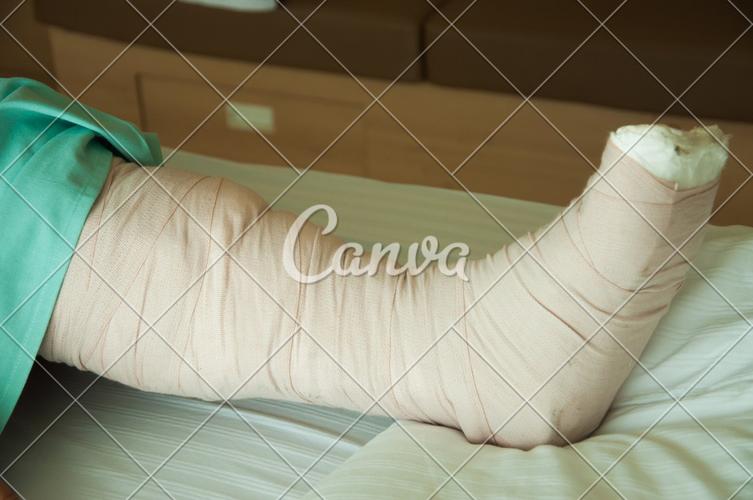 人体足石膏腿生病健康保健四肢绷带摄影部分图片