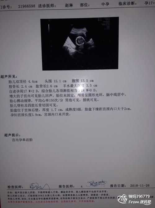 看一下男宝还是女宝