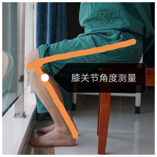 膝关节前交叉韧带重建术后功能锻炼