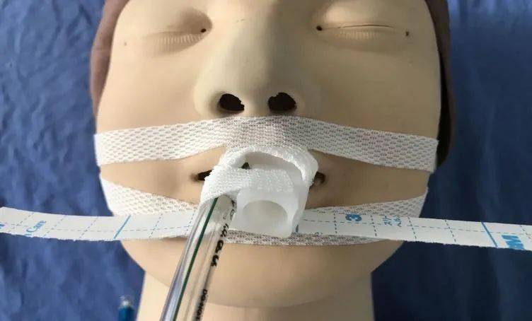 h型气管插管固定流程