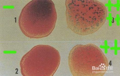 怎样测定鸡白痢抗体
