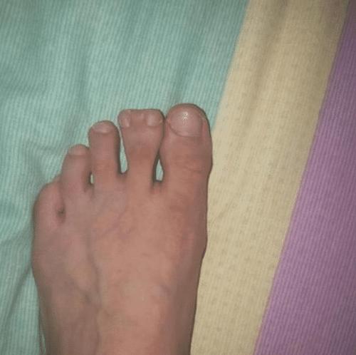 感觉这是脚趾长成了手指啊,这个手指怎么可以这么短啊