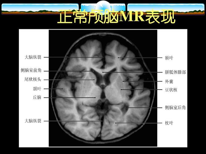 下一页 你可能喜欢 中枢神经系统影像诊断 最全人体解剖图 核磁共振