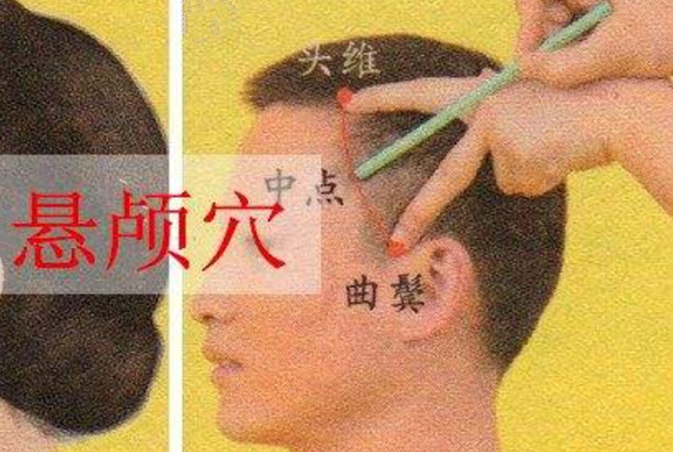 悬颅穴的头部穴位图片