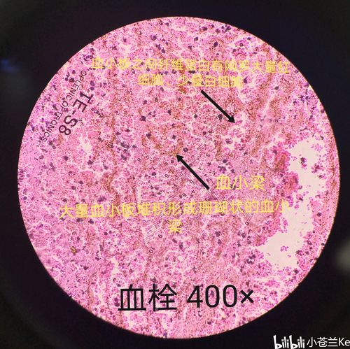 病理学实验切片