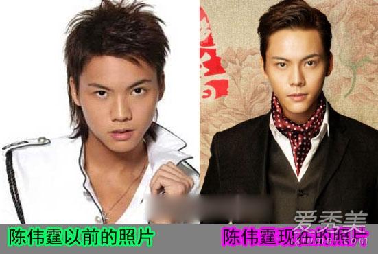 陈伟霆整容了吗 陈伟霆整容前后对比照