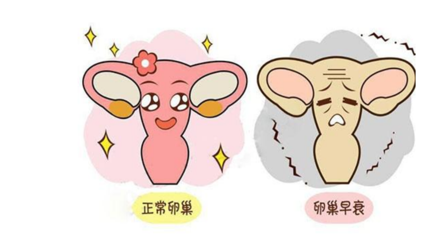 女性"卵巢早衰"不能忽视,了解哪些原因造成的,就知道怎么做了