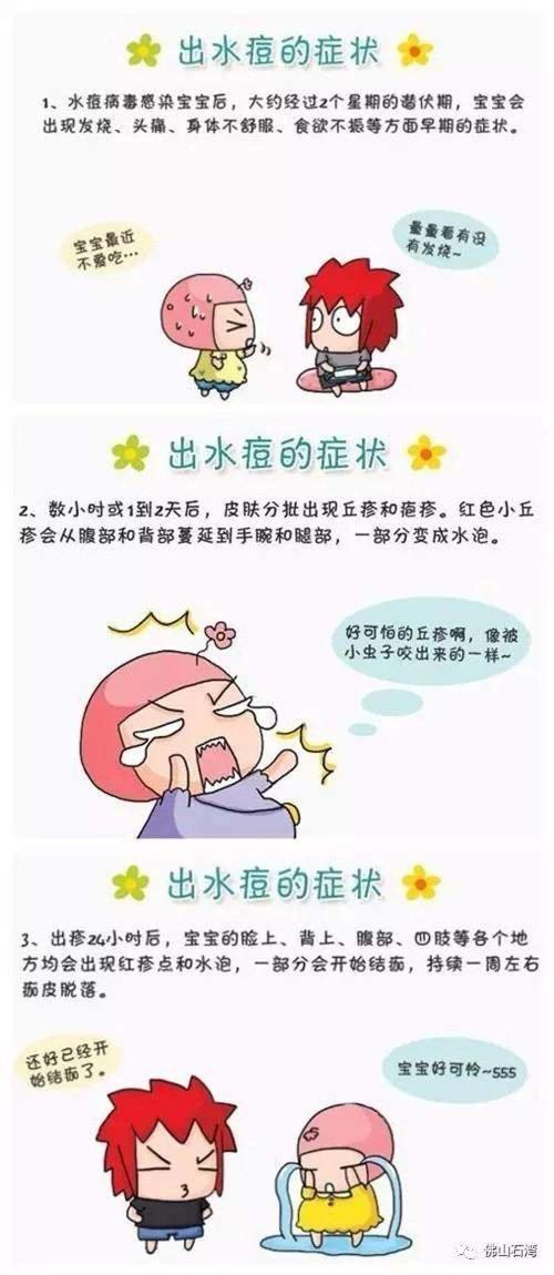 主要症状:水痘病毒感染人体后,经过大约2周的潜伏期,患者可出现