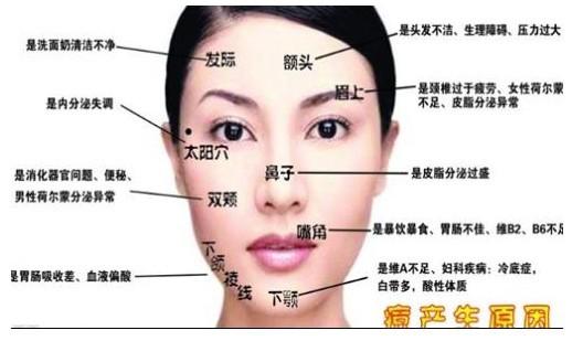 >> 文章内容 >> 脸部长痘位置解读  脸两颊长痘痘是什么原因答:★额头