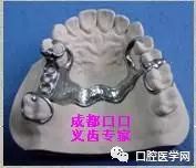 活动义齿支架设计的常见错误及预防