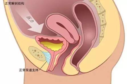 【技术】八医肛肠外科开展经阴补片植入修补直肠前突