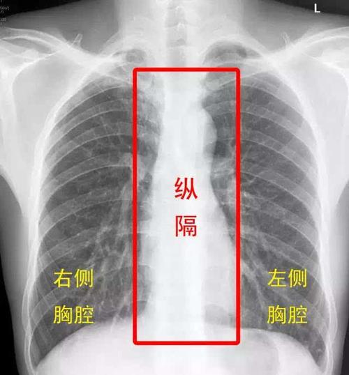 科普节|有点神秘的"纵隔"是个什么东东?