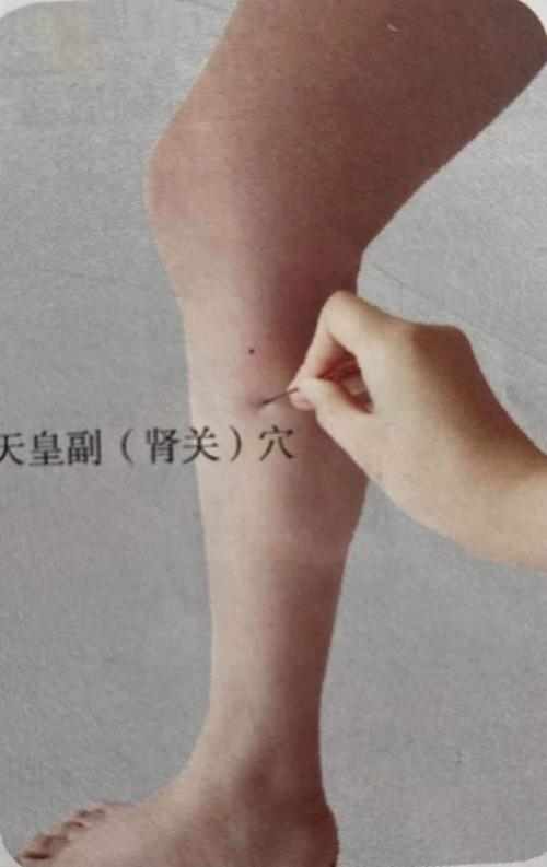 肾关穴在阴陵泉穴下2.5寸,为补肾之要穴.
